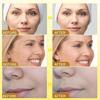 Botox Bee Venom Wrinkle Cream in Pakistan | Anti-Aging & Collagen Boosting Moisturizer - Essence Trove