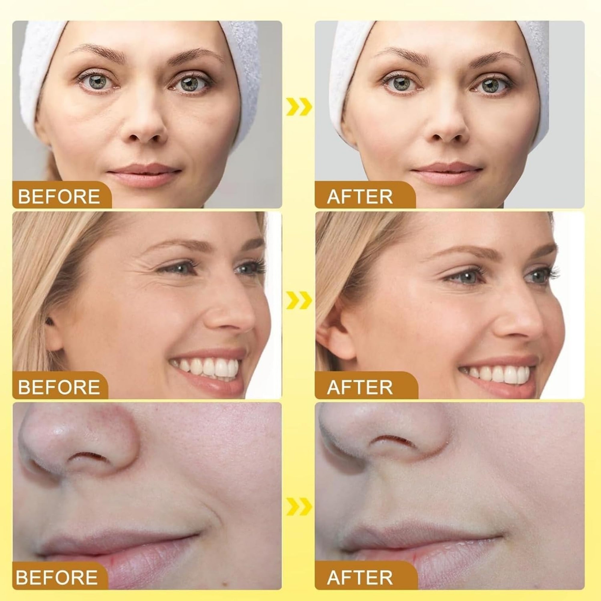 Botox Bee Venom Wrinkle Cream in Pakistan | Anti-Aging & Collagen Boosting Moisturizer - Essence Trove