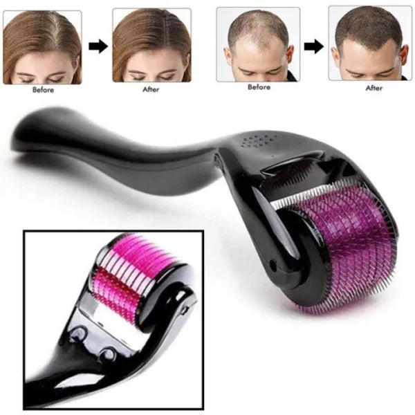 Derma Roller 0.5mm for Hair & Skin Therapy - Essence Trove