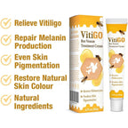 Vitigo Bee Venom Treatment Cream | Natural Skin Repair Hydration Relief Anti-Irritation - Essence Trove