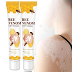 Vitigo Bee Venom Treatment Cream | Natural Skin Repair Hydration Relief Anti-Irritation - Essence Trove