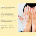 Vitigo Bee Venom Treatment Cream | Natural Skin Repair Hydration Relief Anti-Irritation - Essence Trove